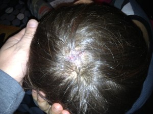 Required medical attention but not serious